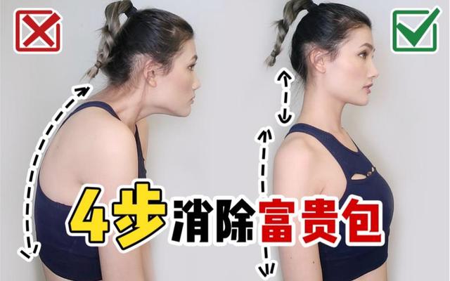 什么睡姿可以消除富贵包