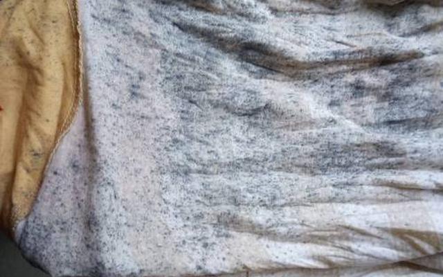 发霉的衣服怎么洗掉霉斑、衣服发霉了怎么才能洗掉