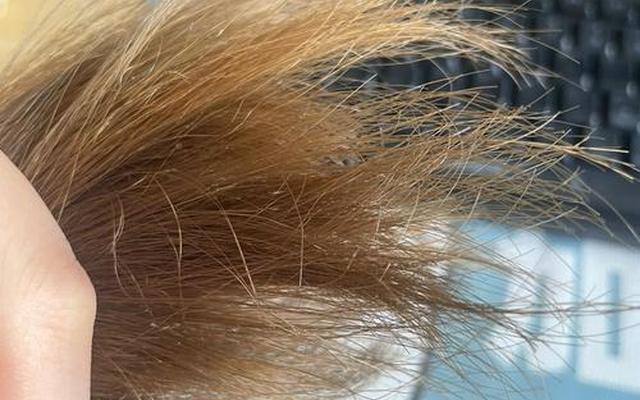 头发特别干枯毛躁怎么办