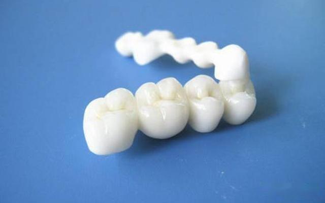 做一个牙冠费用多少