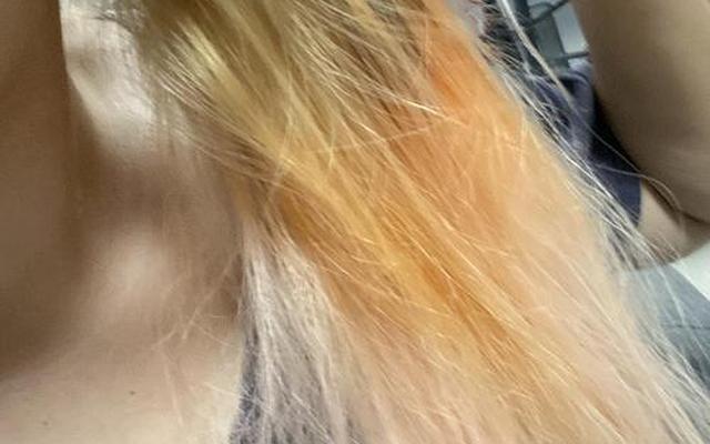 漂头发掉发严重还会长吗