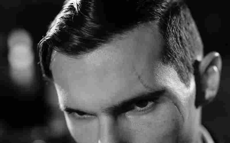 有哪些日常护理能减缓老年斑的加重